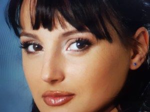 kızlık zarı dikimi sonuçlar