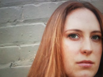 Flep yöntemi yaptırdım