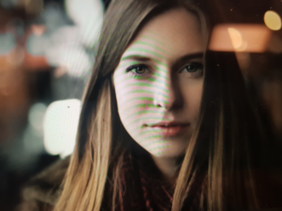 Kızlık zarı dikimi ekşi