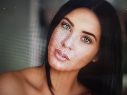 Kızlık zarı dikimi kesin kanar mı ?